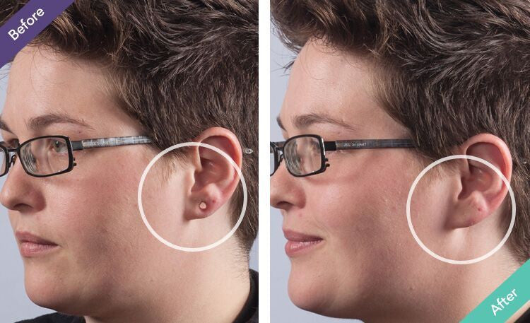 Dermaflage Scar Concealer Kit